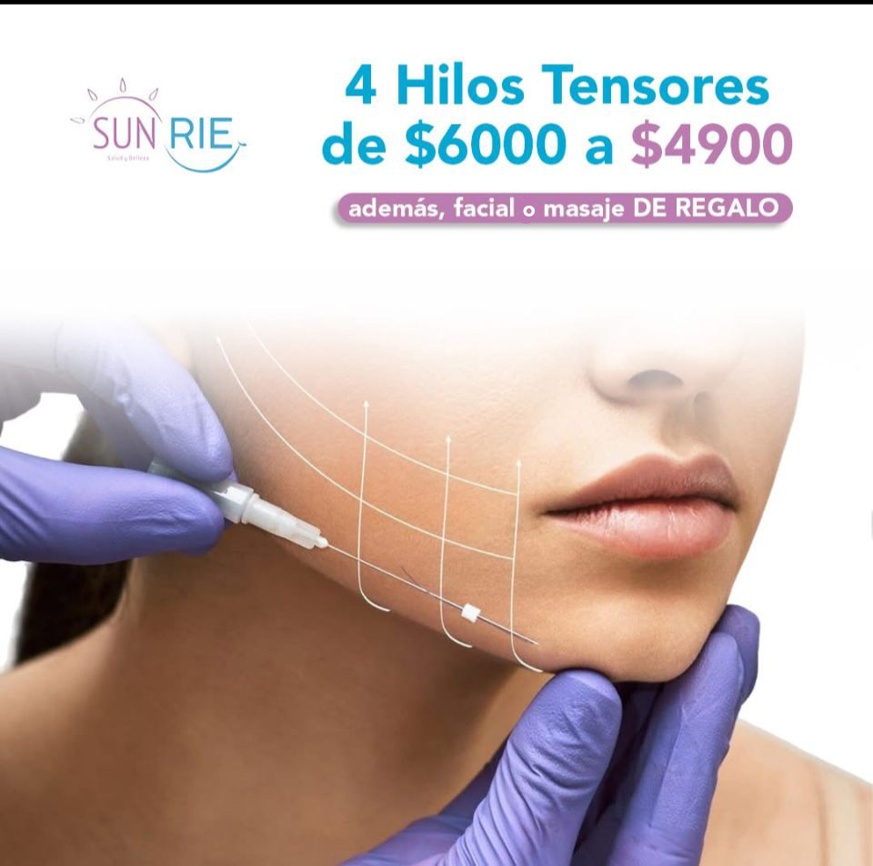 Hilos tensores